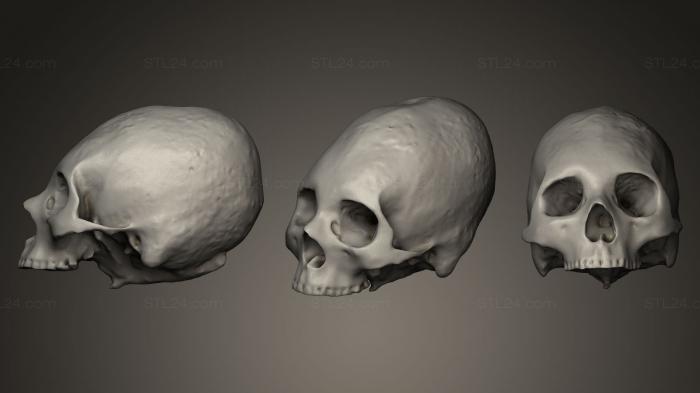 Anatomy of skeletons and skulls (Human Skull Trepanation, ANTM_0026) 3D models for cnc