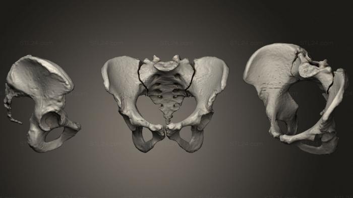 Anatomy of skeletons and skulls (PELVIS H+M, ANTM_1573) 3D models for cnc