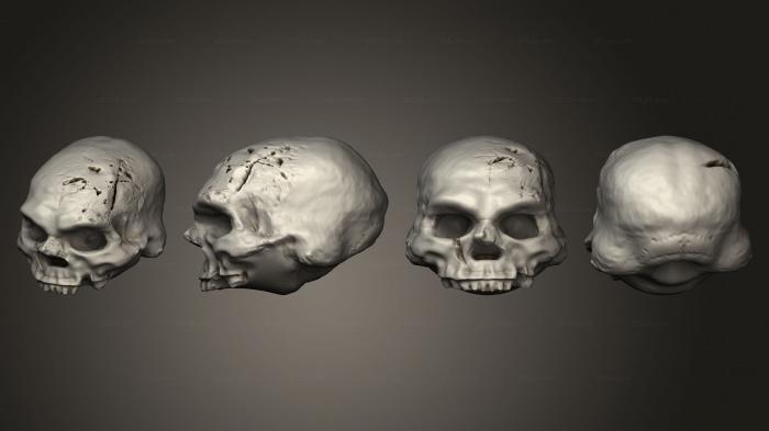 Anatomy of skeletons and skulls (Stretch Goals Skulls Vol 2 dwarf skull B, ANTM_1775) 3D models for cnc