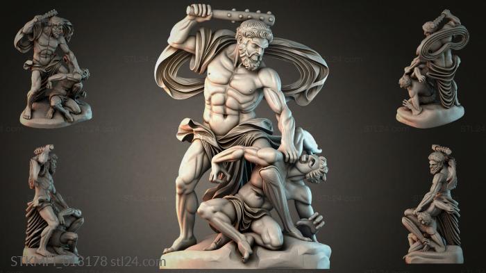 STKMFI_013178 3d STL model